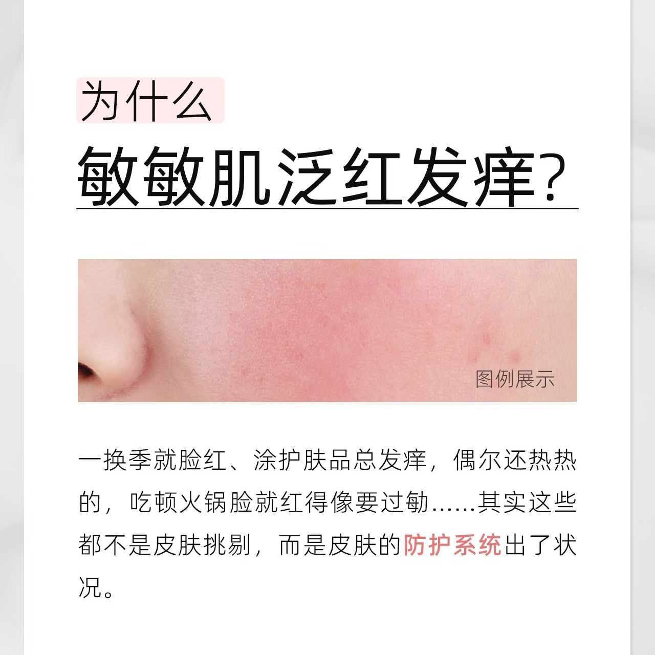 敏敏肌的真相